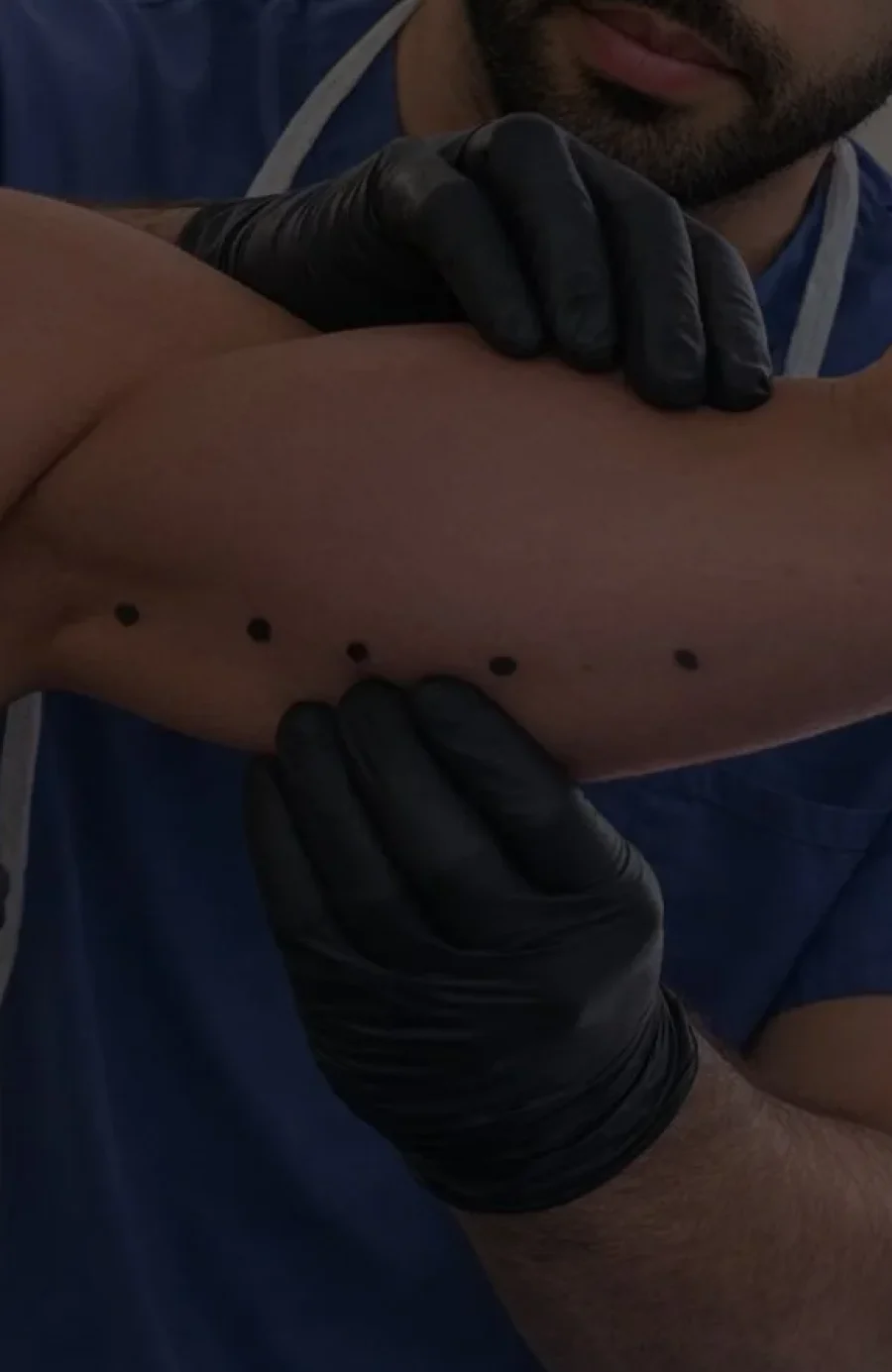 Scars and keloids assessed at Dr Sultan's clinic in Chelsea