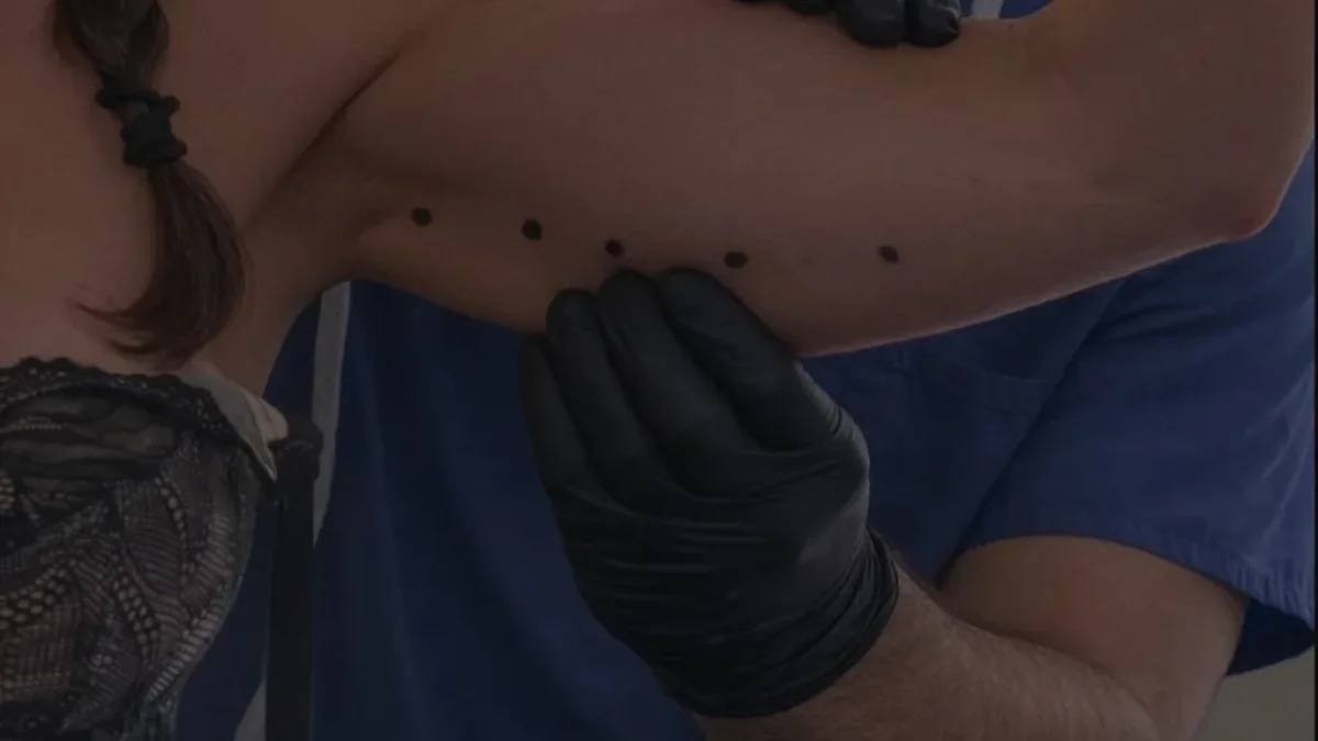 Loose skin after weight loss treatment at Dr Sultan's Chelsea clinic