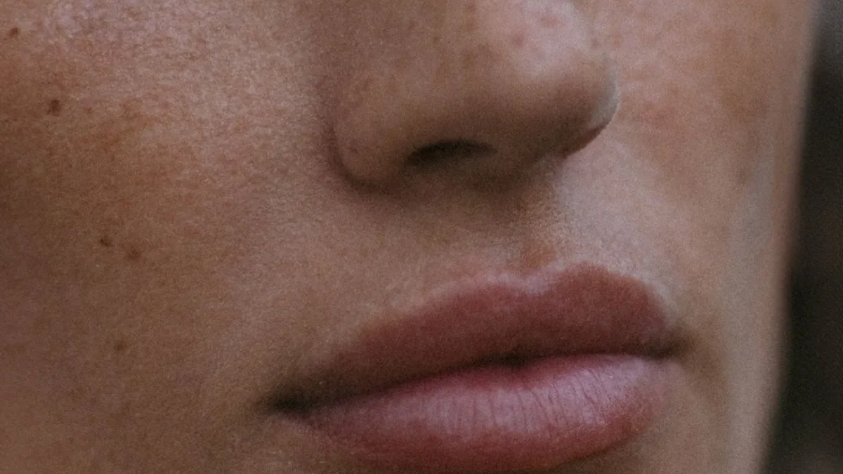 Facial hollowness treatment at Dr Sultan's Chelsea clinic