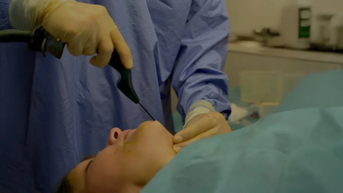 Jawline and double chin treatment at Dr Sultan's Chelsea clinic