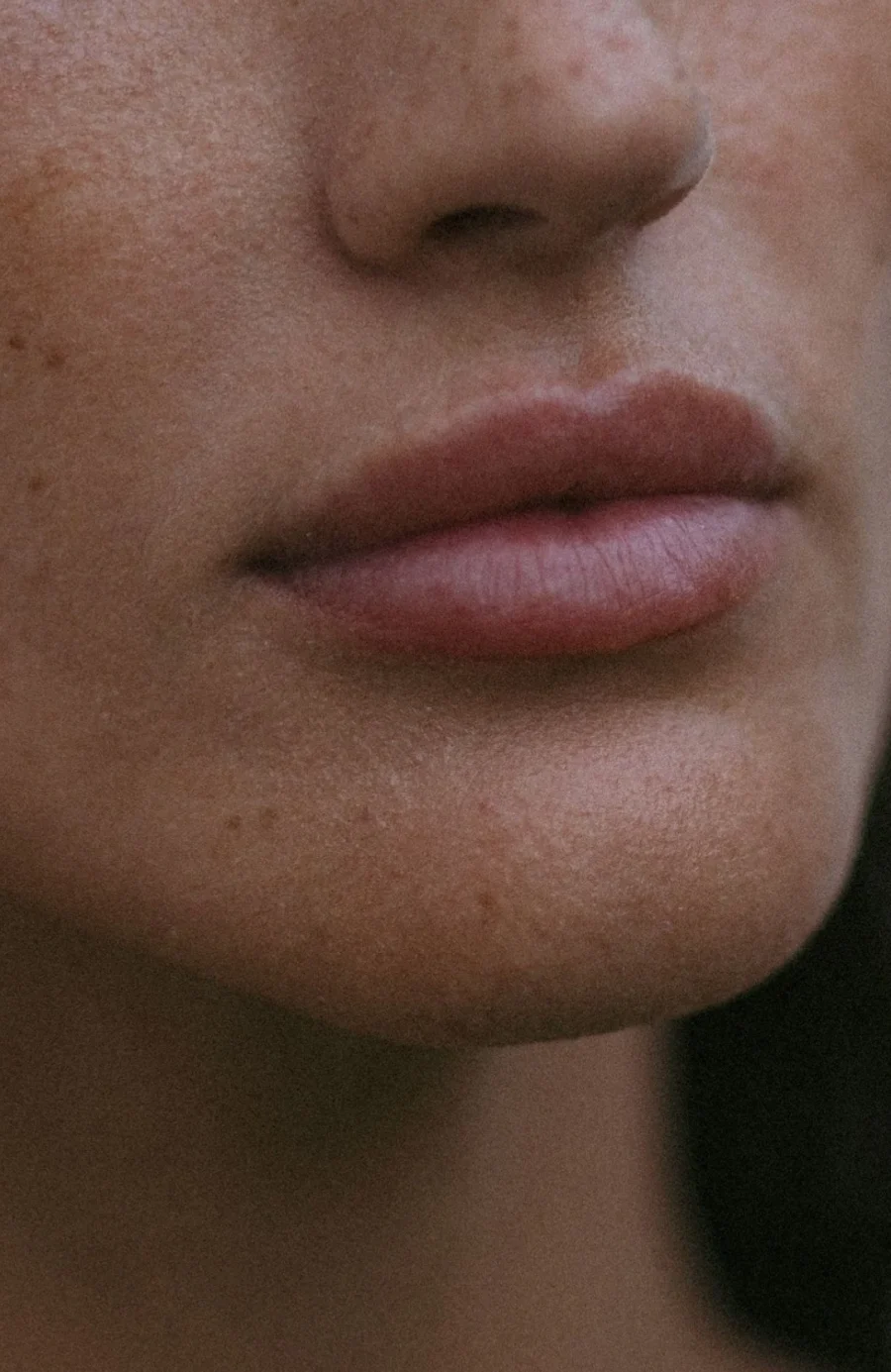 Thin or lined lips assessed at Dr Sultan's clinic in Chelsea